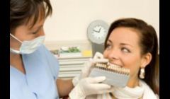 veneers Anchorage