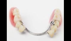 denture repair Anchorage
