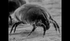 dust mites