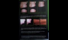 Results in 45 minutes GUARANTEED! 