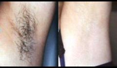 Tired of shaving and waxing? That's why we are here for you!